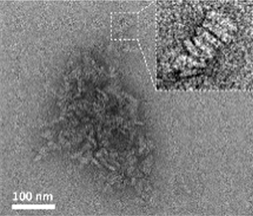 TEM image of Glidacell