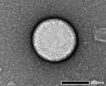 Liposome TEM