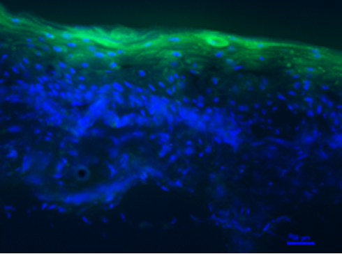 General lipid nanoparticles
